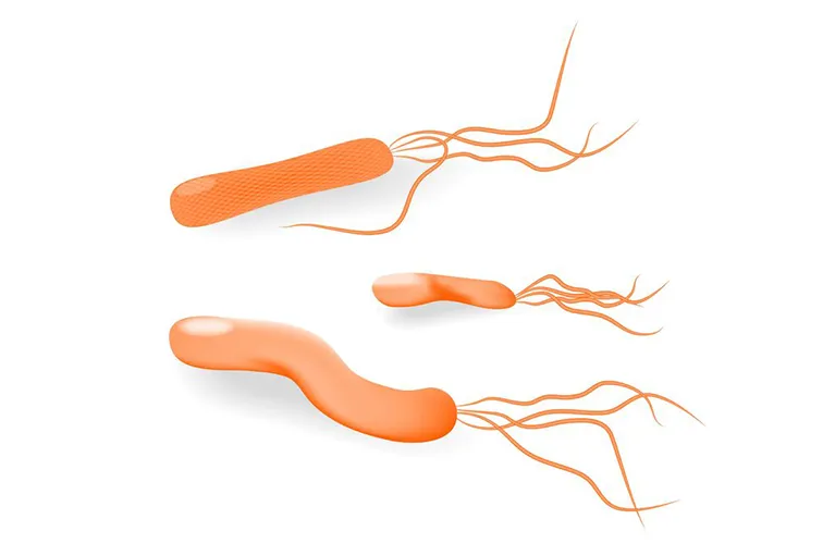 ピロリ菌と胃癌